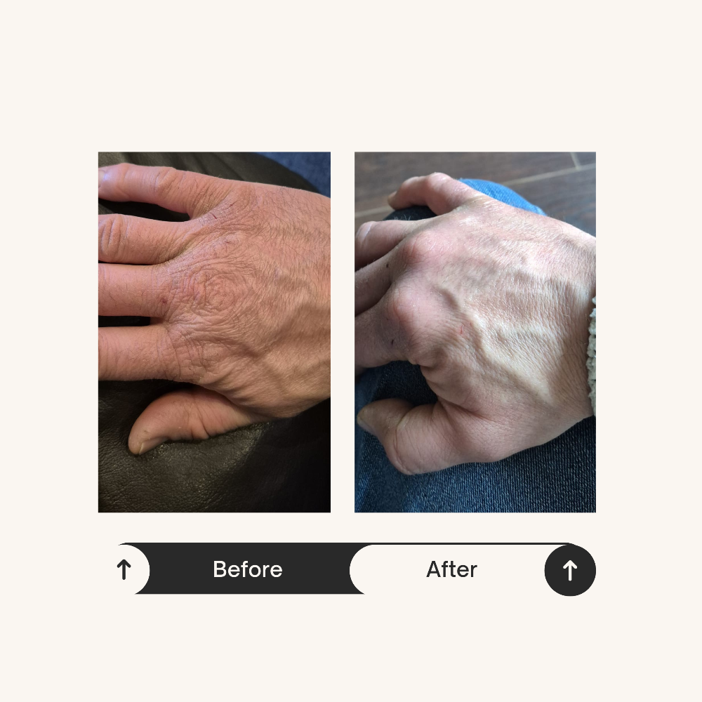 Before and after photo of window cleaner Andy’s hands using ReCalm Beauty Balm to transform sore, chapped hands into supple, smooth skin.